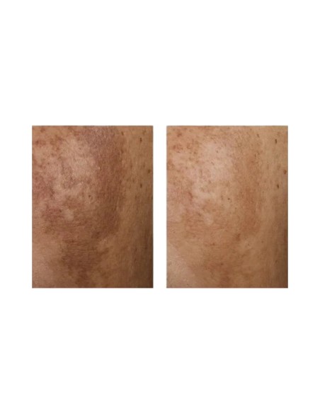 Eucerin Anti Pigment Night Cream 50ML